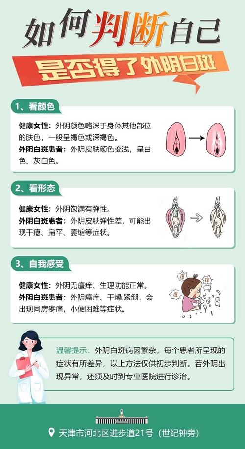 女性妇科白斑病是什么症状,女性妇科白斑病是什么症状图片